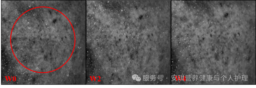 受试者（编号29）黑斑图像比照